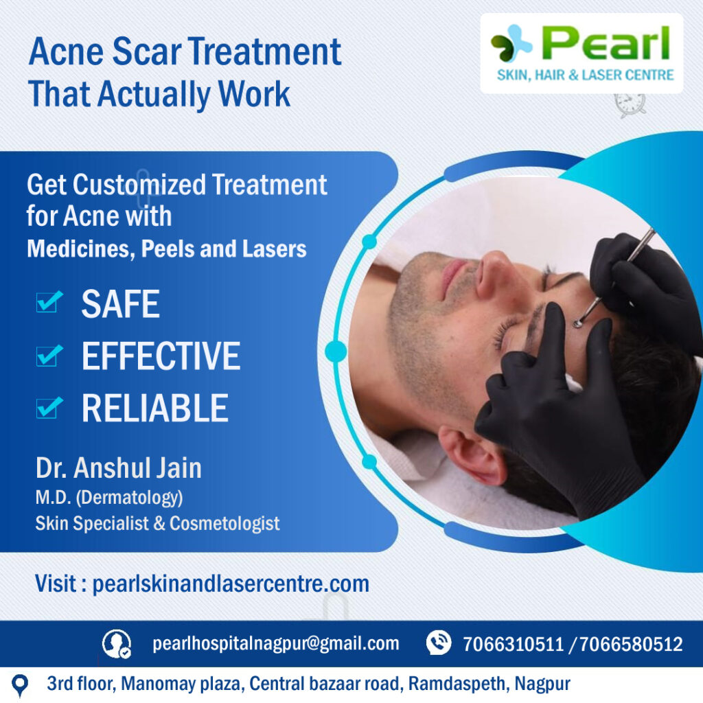 Neck Treatment For Acne Scars